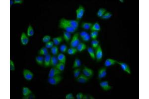 Immunofluorescence staining of Hela cells with ABIN7152990 at 1:133, counter-stained with DAPI. (FOLR2 抗体  (AA 35-167))