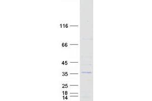 Western Blotting (WB) image for Synovial Sarcoma, X Breakpoint 5 (SSX5) (Transcript Variant 1) protein (Myc-DYKDDDDK Tag) (ABIN2732739)