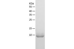 Western Blotting (WB) image for BolA Homolog 3 (BOLA3) (AA 1-107) protein (His tag) (ABIN7287471) (BOLA3 Protein (AA 1-107) (His tag))