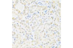 Immunohistochemistry of paraffin-embedded mouse kidney using SUMO1 Antibody (ABIN5971157) at dilution of 1/200 (40x lens). (SUMO1 抗体)