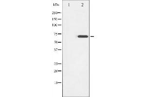 Western blot analysis of ZAP-70 phosphorylation expression in Jurkat whole cell lysates,The lane on the left is treated with the antigen-specific peptide. (ZAP70 抗体  (pTyr319))