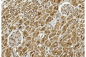 Immunohistochemical analysis of paraffin-embedded Human kidney section using Pink1 am8437c. (ULK3 抗体  (C-Term))