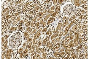 Immunohistochemical analysis of paraffin-embedded Human kidney section using Pink1 am8437c. (ULK3 抗体  (C-Term))