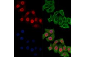 Phospho-MCM2 (Ser108) Antibody staining Hela cells(heat shock treatment) by IF/ICC.