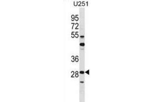 Western Blotting (WB) image for anti-FOS-Like Antigen 2 (FOSL2) antibody (ABIN2998778) (FOSL2 抗体)