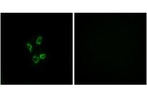 Immunofluorescence analysis of HuvEc cells, using Cytochrome P450 4Z1 Antibody. (CYP4Z1 抗体  (AA 71-120))