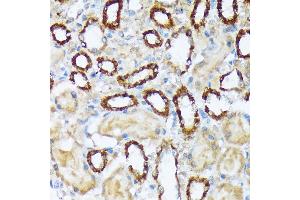 Immunohistochemistry of paraffin-embedded rat kidney using W/W/W Rabbit mAb (ABIN7271346) at dilution of 1:100 (40x lens). (WASF2 抗体)