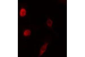 ABIN6276550 staining HeLa cells by IF/ICC. (NEUROD1 抗体  (N-Term))