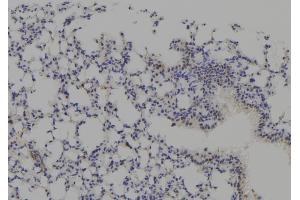 ABIN6277771 at 1/100 staining Mouse lung tissue by IHC-P. (CSNK2A1/CK II alpha 抗体  (N-Term))