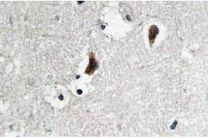 Immunohistochemistry (IHC) analyzes of c-Src antibody in paraffin-embedded human brain tissue. (NCOA1 抗体)