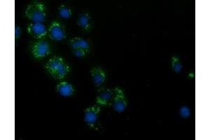 Immunofluorescence (IF) image for anti-Hydroxyacid Oxidase (Glycolate Oxidase) 1 (HAO1) antibody (ABIN1498576) (HAO1 抗体)