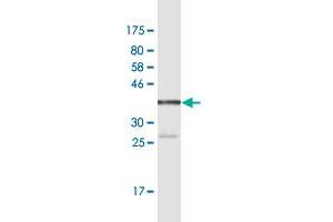 Western Blotting (WB) image for anti-Tumor Protein, Translationally-Controlled 1 (TPT1) (AA 35-138) antibody (ABIN950129)
