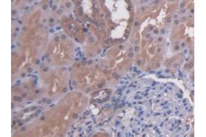DAB staining on IHC-P; Samples: Human Kidney Tissue (N-Acetyl alpha-D-Glucosaminidase (AA 485-743) 抗体)