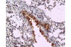Formalin-fixed and paraffin embedded mouse lung tissue labeled with Anti-MyD88 Polyclonal Antibody, Unconjugated  at 1:200, followed by conjugation to the secondary antibody and DAB staining (MYD88 抗体  (AA 201-296))