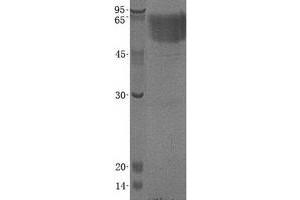 Validation with Western Blot (THSD1 Protein (Transcript Variant 1) (His tag))