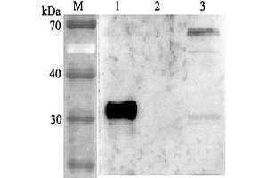 Western blot analysis using anti-ANGPTL4 (human), pAb  at 1:2'000 dilution.