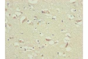 Immunohistochemistry of paraffin-embedded human brain tissue using ABIN7173719 at dilution of 1:100 (TTLL7 抗体  (AA 1-260))