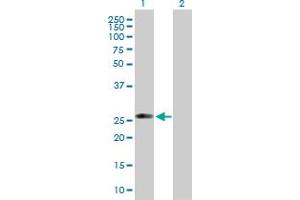 Western Blot analysis of C1QTNF5 expression in transfected 293T cell line by C1QTNF5 MaxPab polyclonal antibody. (CTRP5 抗体  (AA 1-243))