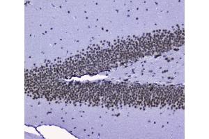 IHC analysis of nmt55/p54nrb using anti-nmt55/p54nrb antibody (ABIN3044530). (NONO 抗体  (N-Term))