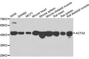 Western blot analysis of extracts of various cell lines, using ACTA2 antibody. (Smooth Muscle Actin 抗体)