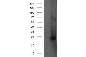 Image no. 2 for anti-Fetal and Adult Testis Expressed 1 (FATE1) antibody (ABIN1498223) (FATE1 抗体)