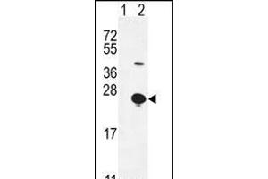 Western blot analysis of EPGN (arrow) using rabbit polyclonal EPGN Antibody (N-term) (ABIN655189 and ABIN2844805).