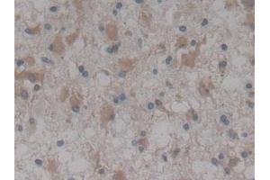 Immunohistochemistry (IHC) image for anti-Neurotrophic tyrosine Kinase, Receptor, Type 3 (NTRK3) (AA 32-429) antibody (ABIN7443641)