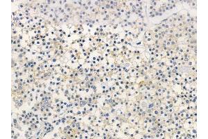 ABIN6261574 and ABIN6266963 at 1/100 staining human pituitary adenoma by IHC-P. (Epsin 1 抗体)