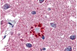 Human Brain, Cortex, Senile Plaque (formalin-fixed, paraffin-embedded) stained with TCF21 antibody ABIN462190 followed by biotinylated goat anti-rabbit IgG secondary antibody ABIN481713, alkaline phosphatase-streptavidin and chromogen. (TCF21 抗体  (AA 42-91))