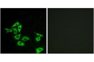 Immunofluorescence analysis of A549 cells, using FZD8 Antibody. (FZD8 抗体  (AA 31-80))