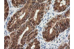 Image no. 1 for anti-Hydroxyprostaglandin Dehydrogenase 15-(NAD) (HPGD) antibody (ABIN1496363) (HPGD 抗体)