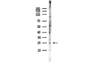 anti-Sex Determining Region Y (SRY) (Internal Region) antibody