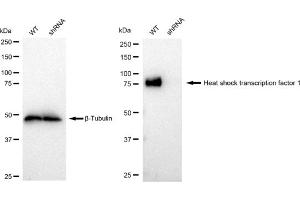 Western blotting analysis using Heat shock transcription factor 1 antibody (ABIN7798861).