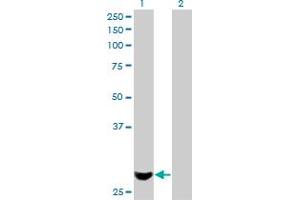 Western Blot analysis of PMM2 expression in transfected 293T cell line by PMM2 monoclonal antibody (M01), clone 2E9. (PMM2 抗体  (AA 47-111))