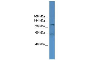WB Suggested Anti-UBA6 Antibody Titration: 0. (UBA6 抗体  (Middle Region))
