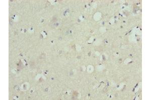 Immunohistochemistry of paraffin-embedded human brain tissue using ABIN7176547 at dilution of 1:100 (ZNF821 抗体  (AA 1-370))