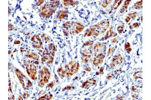 Formalin-fixed, paraffin-embedded human Uterus stained with Caldesmon Rabbit Recombinant Monoclonal Antibody (CALD1/1424R). (Recombinant Caldesmon 抗体)