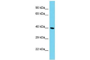 Host: Rabbit Target Name: C12orf70 Sample Type: HepG2 Whole Cell lysates Antibody Dilution: 1.