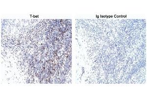 Immunohistochemistry (IHC) image for anti-T-Bet antibody (ABIN967673) (T-Bet 抗体)