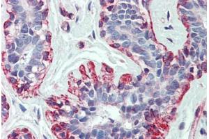 Human Breast: Formalin-Fixed, Paraffin-Embedded (FFPE) (beta Actin 抗体  (C-Term))