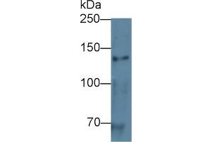 Detection of CDH5 in Human Placenta lysate using Polyclonal Antibody to Cadherin 5 (CDH5)