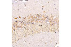 Immunohistochemistry analysis of paraffin-embedded rathippocampususing ALG6 (ABIN7073127) at dilution of 1:1200 (ALG6 抗体)