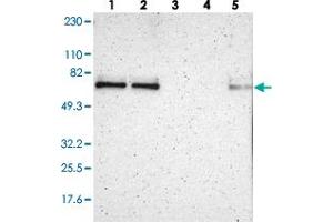 Western blot analysis of Lane 1: RT-4, Lane 2: U-251 MG, Lane 3: Human Plasma, Lane 4: Liver, Lane 5: Tonsil with ZNF384 polyclonal antibody  at 1:250-1:500 dilution. (ZNF384 抗体)