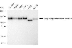 Western blotting analysis using Golgi integral membrane protein 4 antibody (ABIN7798791). (Recombinant Golgi Integral Membrane Protein 4 (GOLIM4) 抗体)