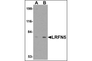 Western blot analysis of LRFN5 in EL4 cell lysate with this product at (A) 0. (LRFN5 抗体  (C-Term))