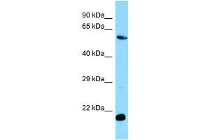 WB Suggested Anti-MOB1B Antibody Titration: 1. (MOBKL1A 抗体  (C-Term))