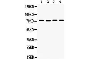 Western Blotting (WB) image for anti-Fragile X Mental Retardation 1 (FMR1) (AA 164-200), (N-Term) antibody (ABIN3042398) (FMR1 抗体  (N-Term))