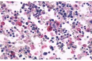 Anti-CD97 antibody  ABIN1048416 IHC staining of human bone marrow. (CD97 抗体  (N-Term))