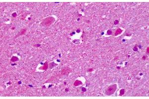 Anti-CELSR2 antibody IHC staining of human brain, cortex, neurons. (CELSR2 抗体  (C-Term))