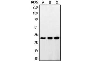 Western blot analysis of RNF144A expression in HeLa (A), HepG2 (B), Jurkat (C) whole cell lysates. (RNF144A 抗体  (Center))